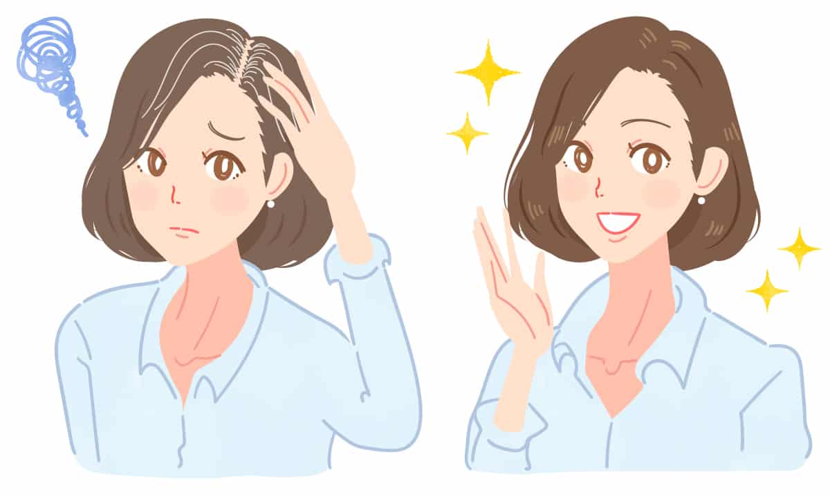 年紀輕輕就長白髮？這樣做對付少年白