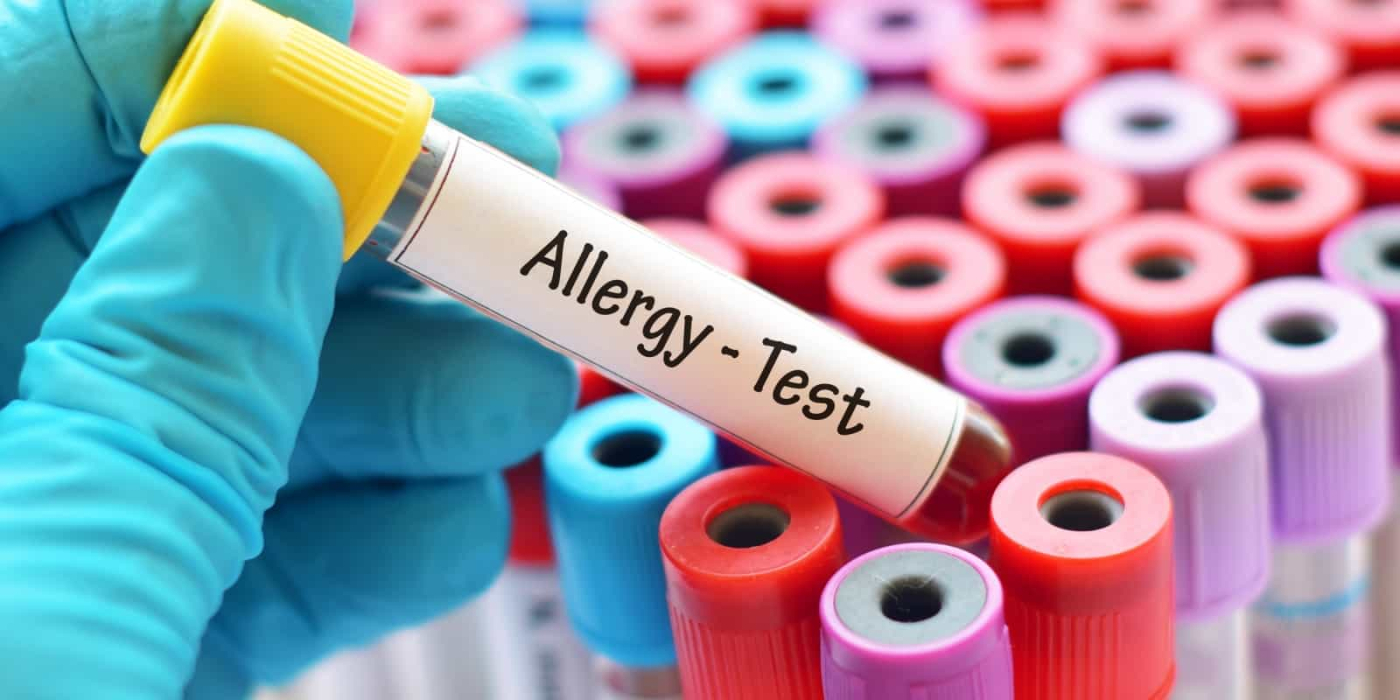 皮膚紅 眼睛癢很煩~找出過敏原有解