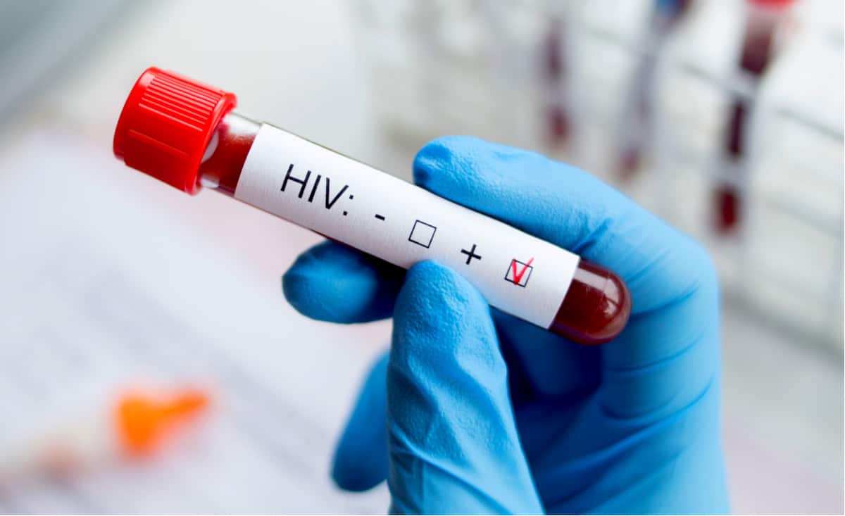 人類免疫缺乏病毒(HIV)