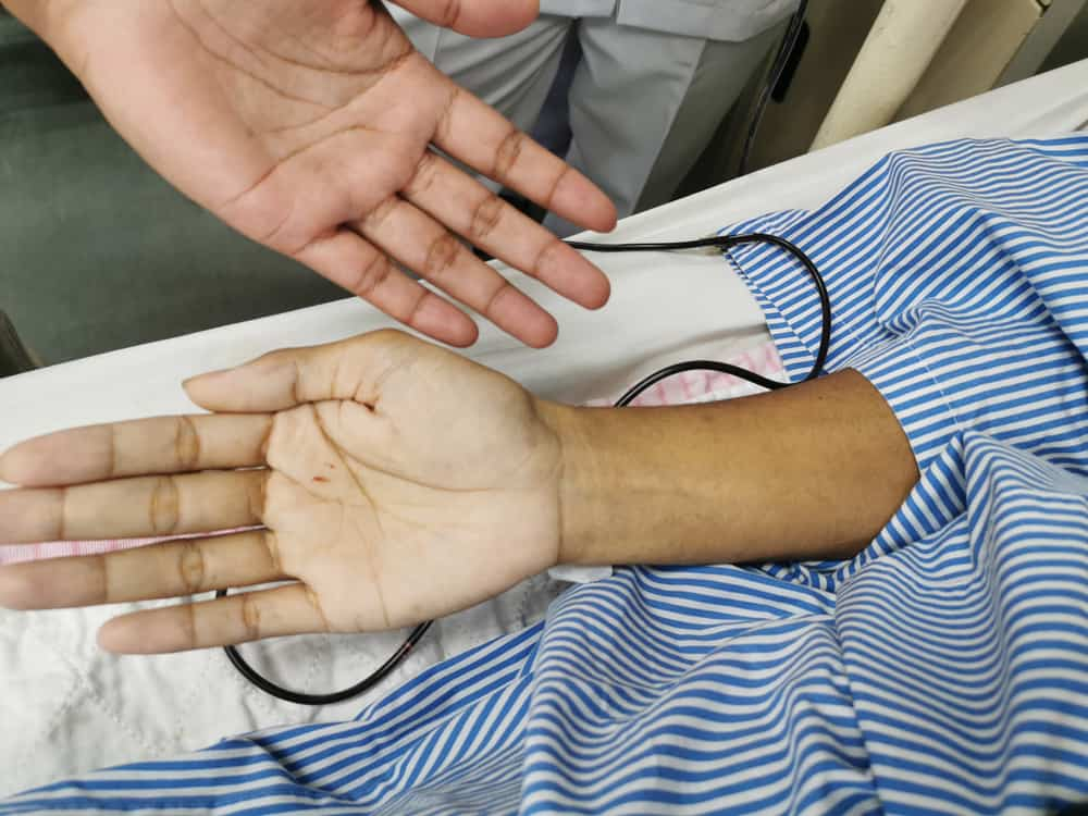 营养不良的3症状！别再乱吃伤害身体了