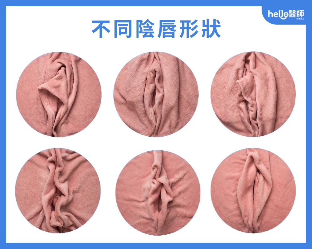 不同陰唇形狀