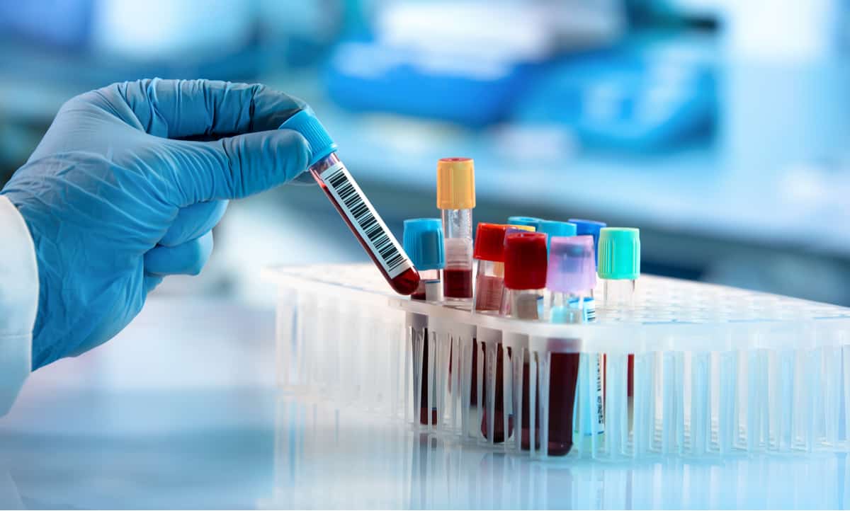 抽血學問大!採血管顏色有不同涵義