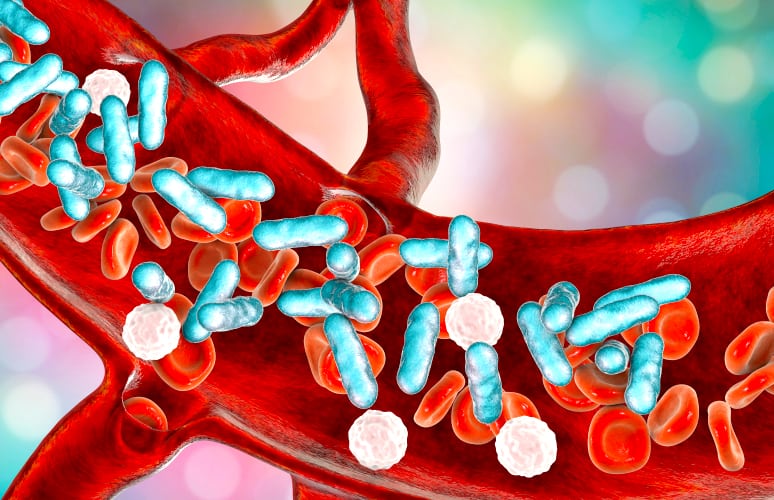 細菌感染恐致命！敗血症的原因、症狀、治療、預防