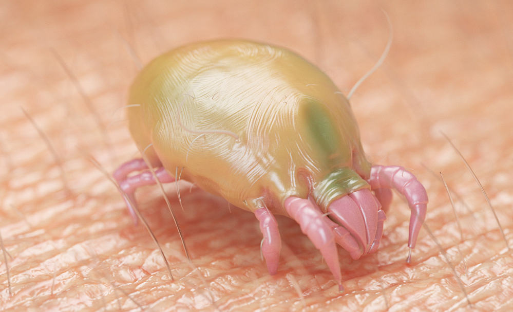 疥瘡傳染性極高！認識成因症狀，6招預防疥蟲上身