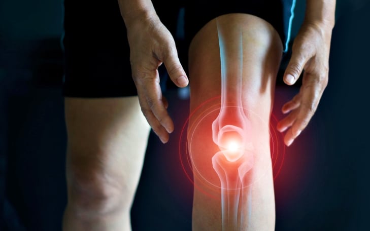 膝蓋扭傷:症狀、原因、診斷、治療