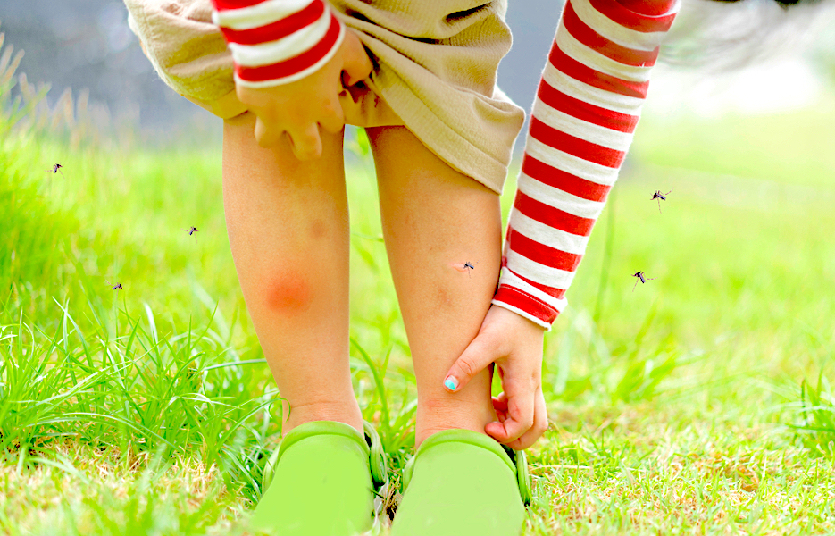 這 6 原因害你老被蚊子叮! 4 個防蚊妙招超實用