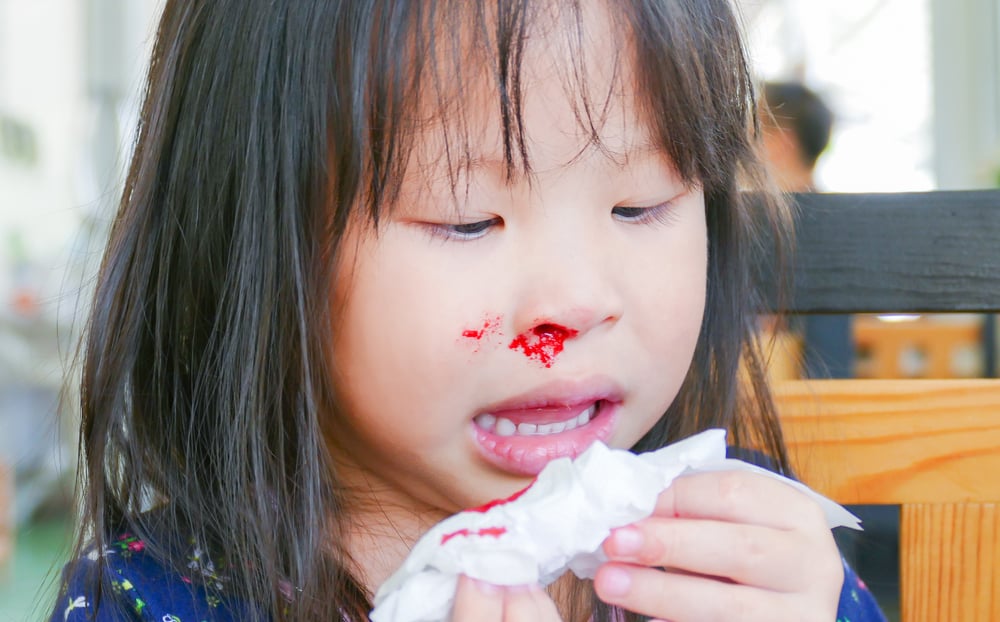 血友病：症狀、原因、治療、如何遺傳、注意事項