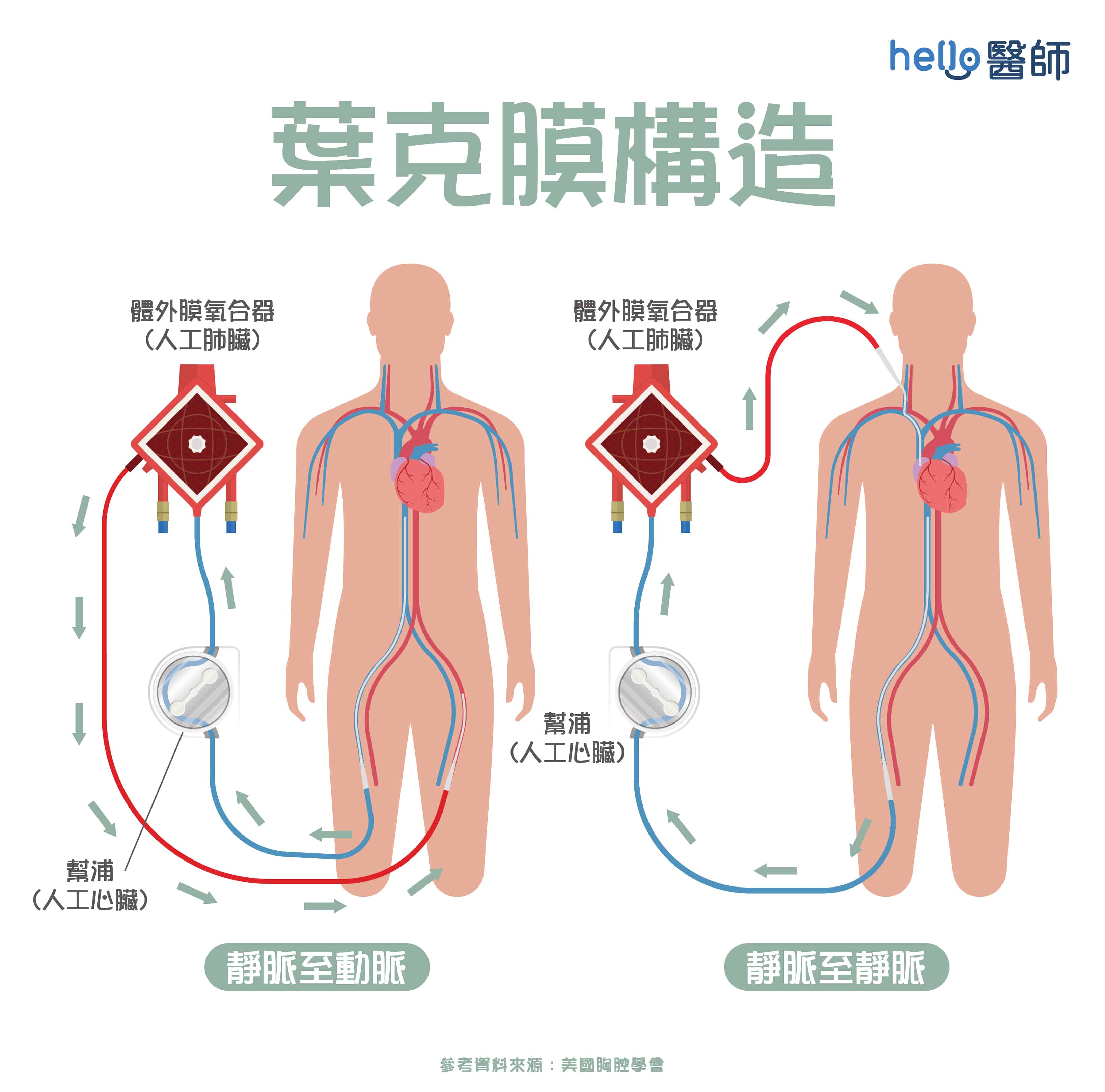 医療用勃起不全ポンプ