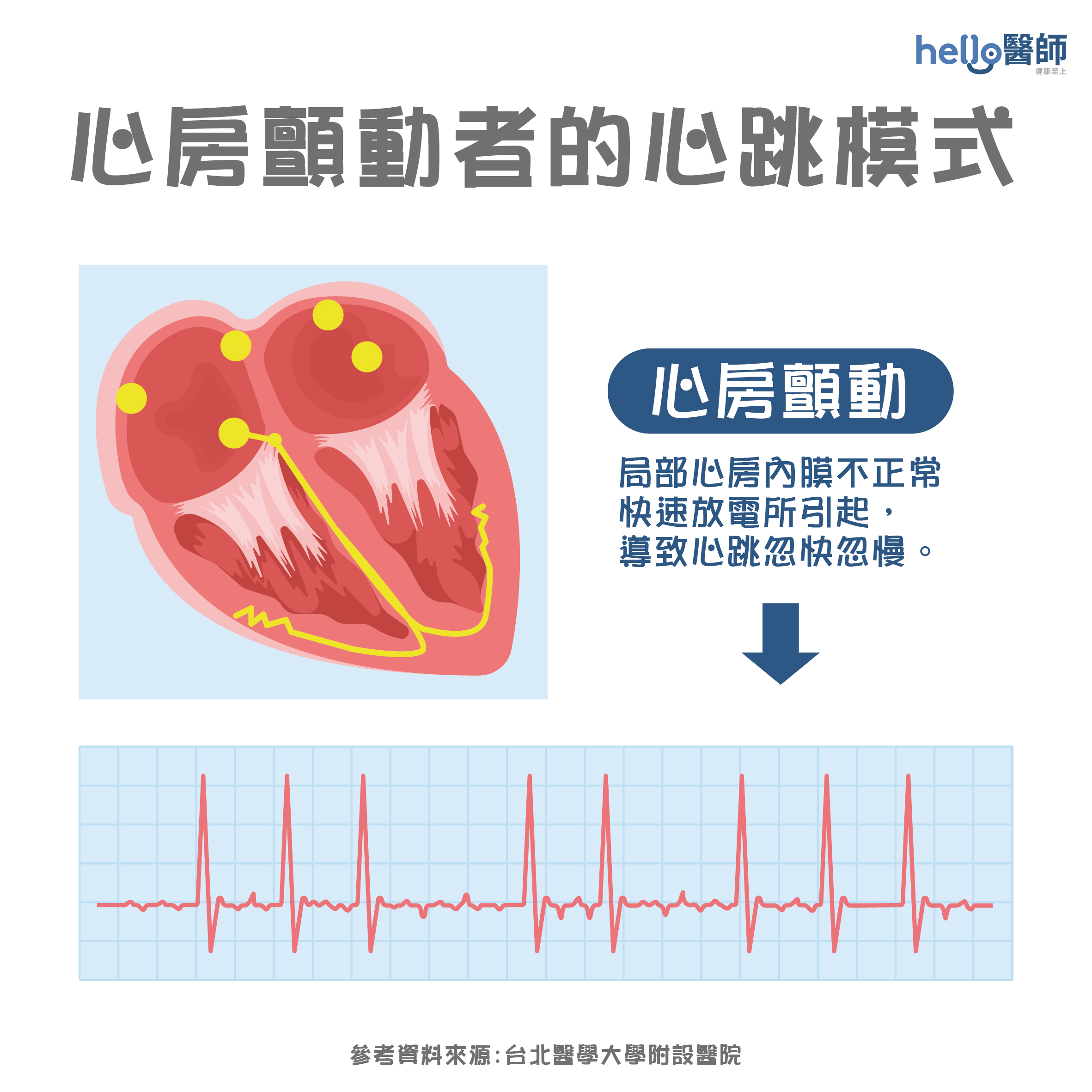 心房顫動有什麼感覺？治療會好嗎？心房顫動症狀、原因解說