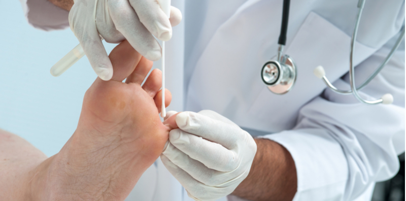 香港腳症狀治療全解析：香港腳原因？會自己好或傳染嗎？