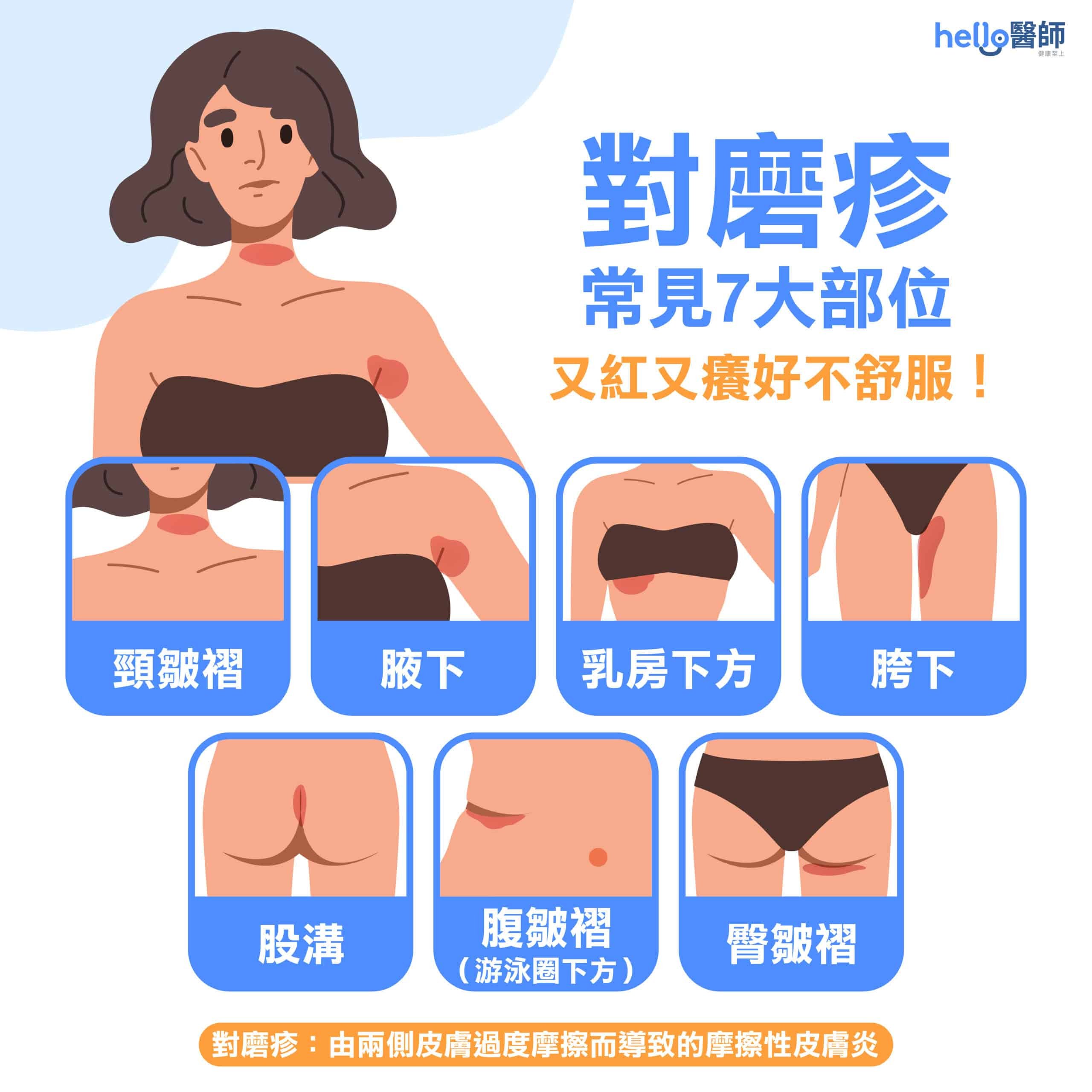 腋下 胯下、腋下紅癢怎麼辦？對磨疹保持乾爽最重要，若