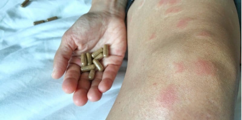 其他皮膚疾病 Hello Yishi 3 4頁