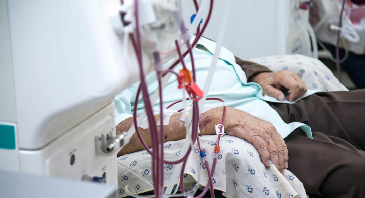洗腎者罹患心臟衰竭10倍於常人 心腎症候群類型、風險、治療詳解