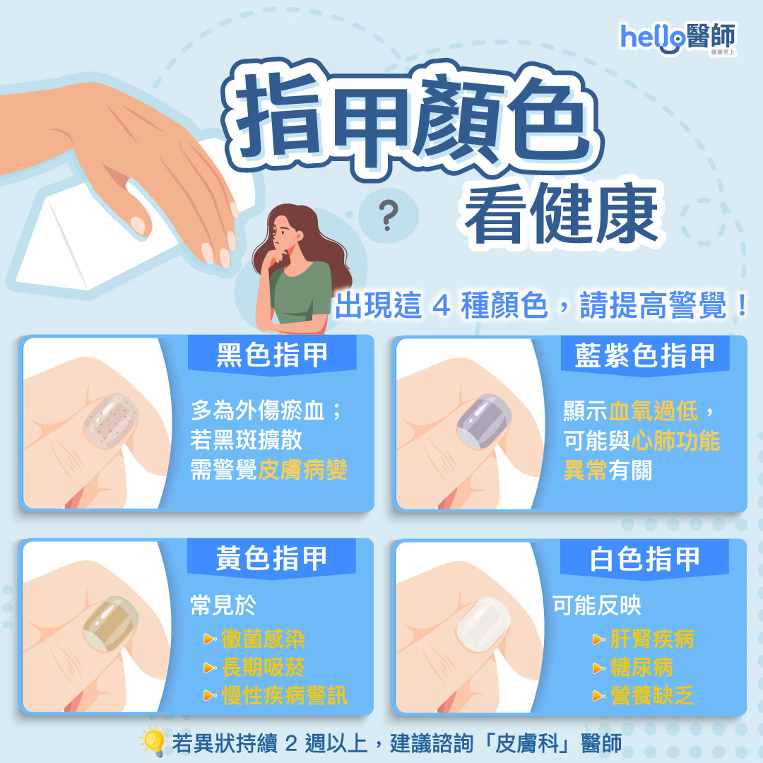 指甲變黑、變紫？指甲顏色透露身體健康，解析4大指甲顏色