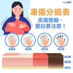 手腳凍傷怎麼辦?有「這症狀」速就醫!凍傷處理、多久會好