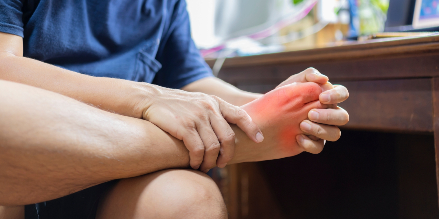 痛風症狀4階段、飲食表公開！痛風原因、前兆、治療、看什麼科