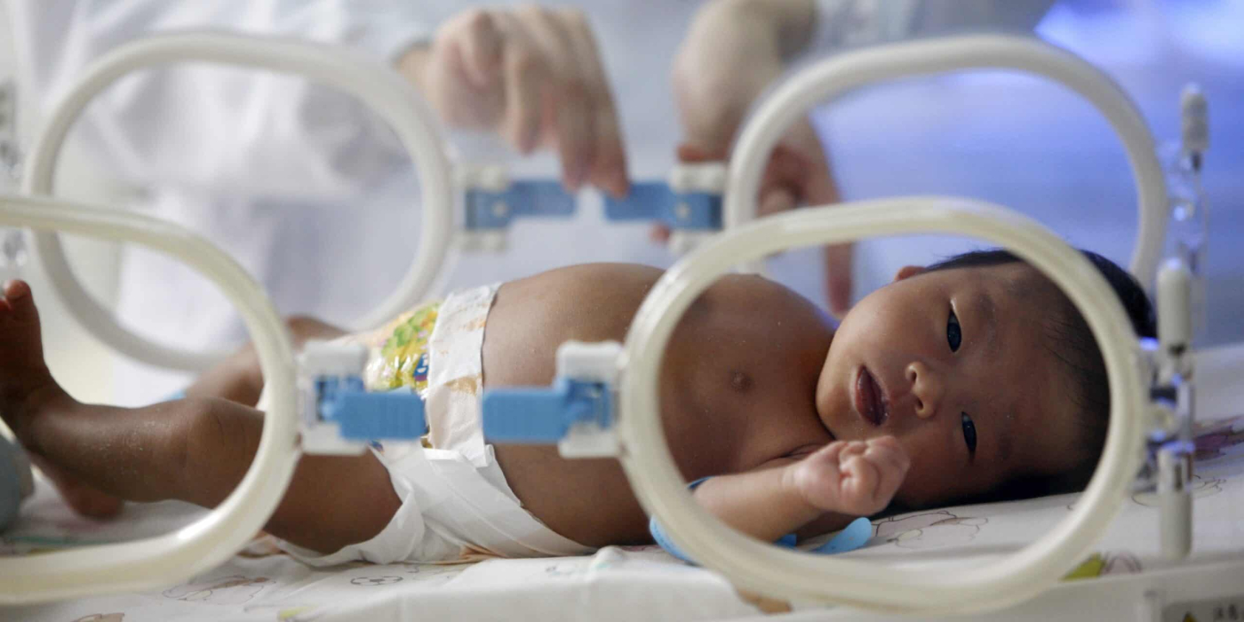 脊柱裂病友心聲「 不帶尿袋出門」　盼健保補助自助式導尿管