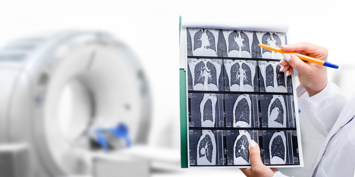 【醫師幫幫我】無聲「新癌王」　腫瘤科名醫吳教恩醫師解析　肺癌早期發現的關鍵密碼與預防方式