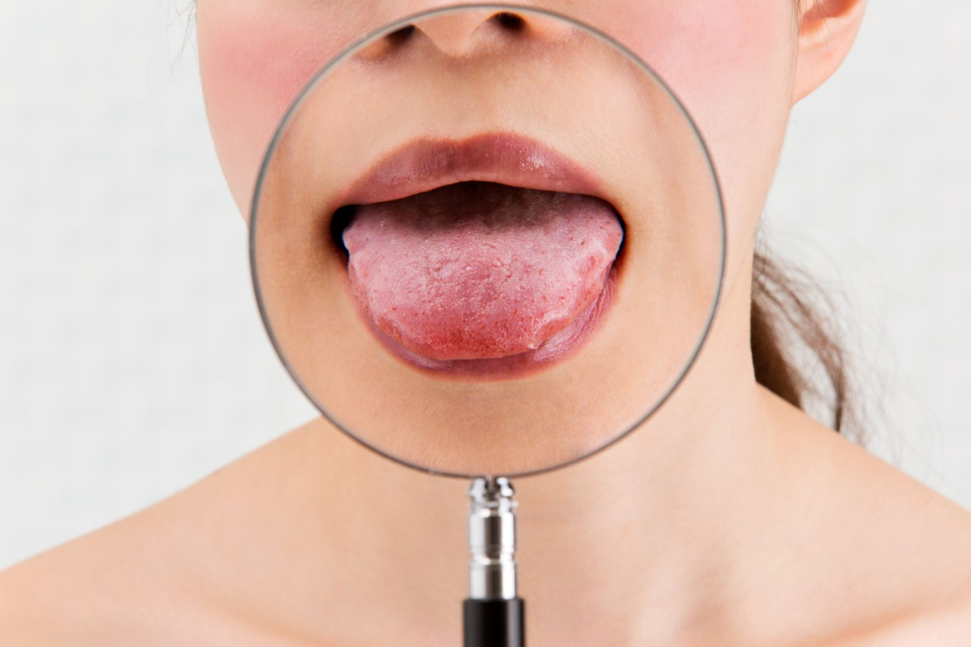 舌頭異常疼痛？搞懂常見3種口腔疾病、9大原因