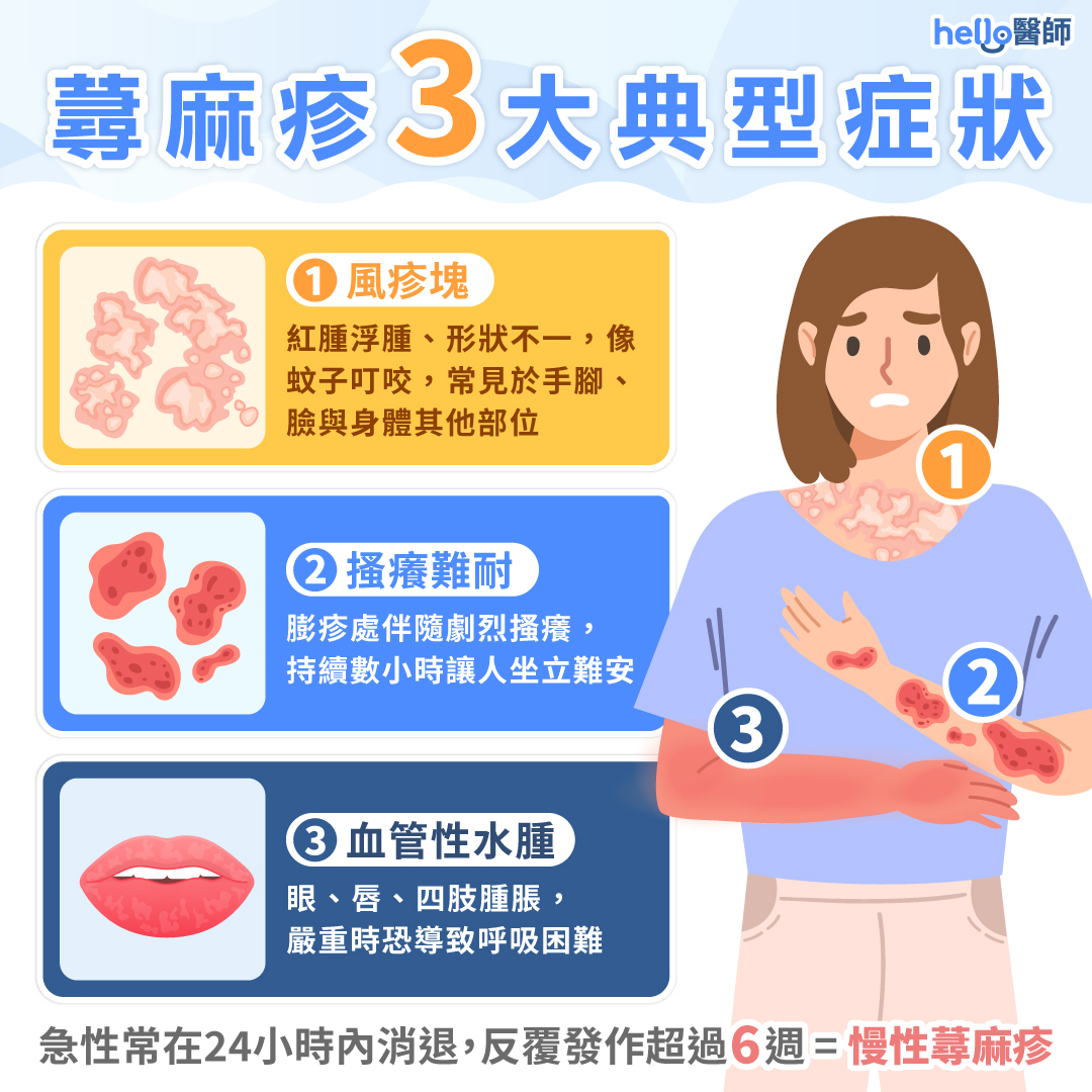蕁麻疹5原因！蕁麻疹症狀、飲食、治療、止癢緊急處理一次懂