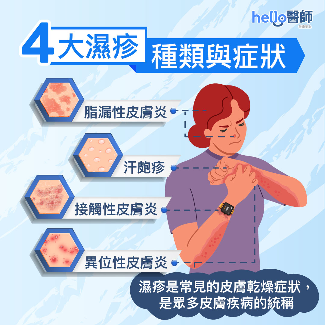 遠離濕疹:濕疹的症狀與成因、吃這些遠離濕疹
