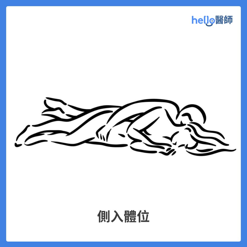 側入體位