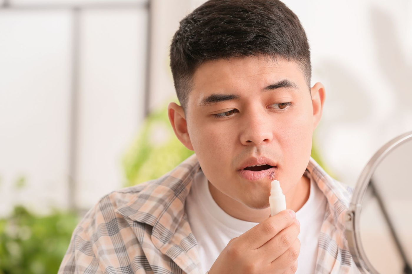 唇炎是什麼？唇炎分2種，症狀原因大不同！治療藥膏完整看