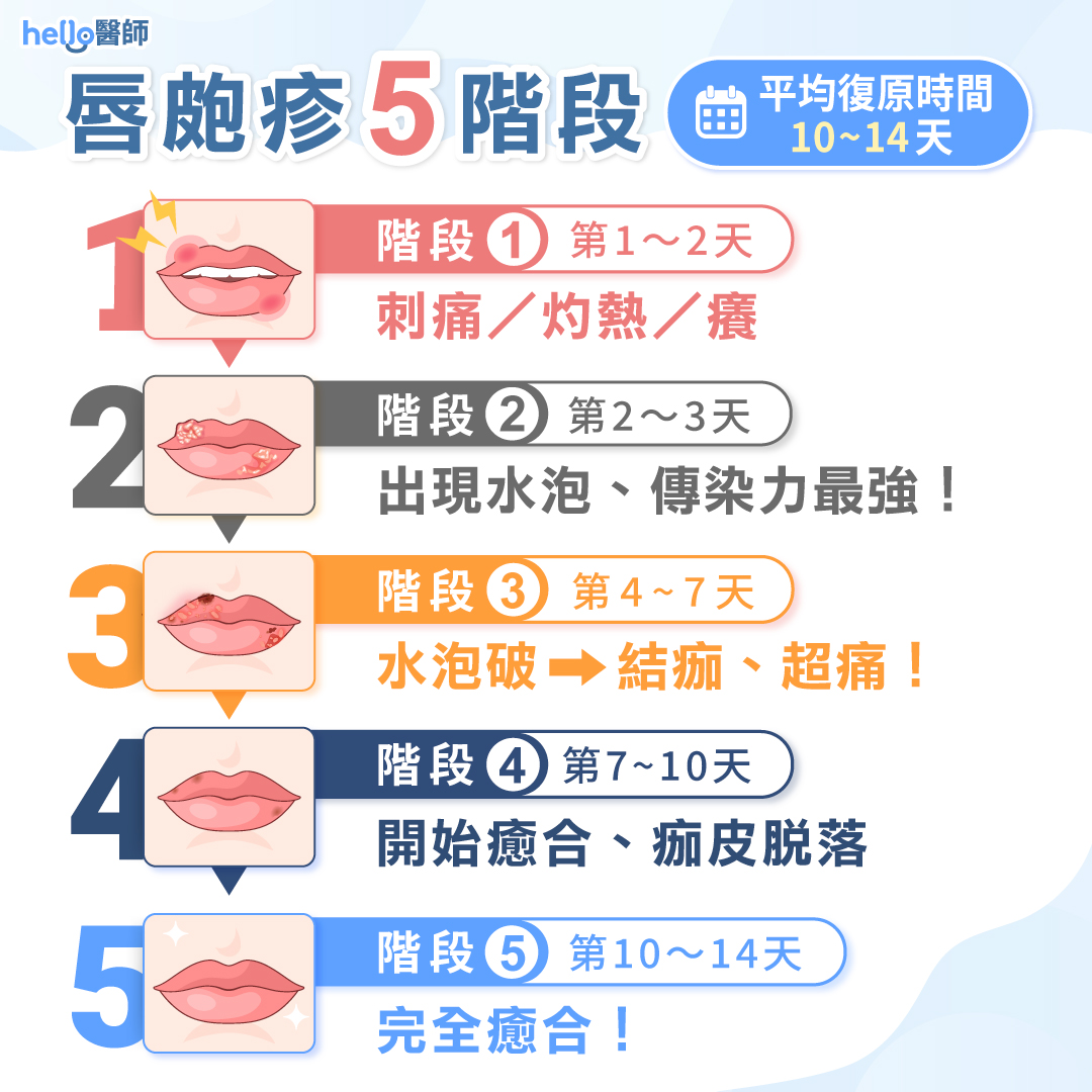 唇皰疹原因？嘴唇皰疹多久會好？會傳染嗎？藥膏擦哪款？