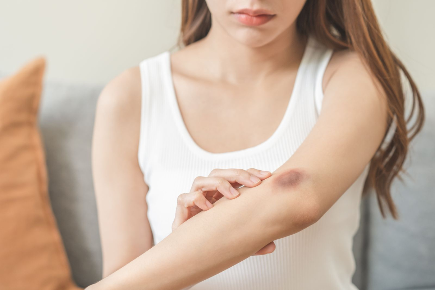 瘀青怎麼消？要冰敷還熱敷？快速消瘀青6處理方法、藥膏解析