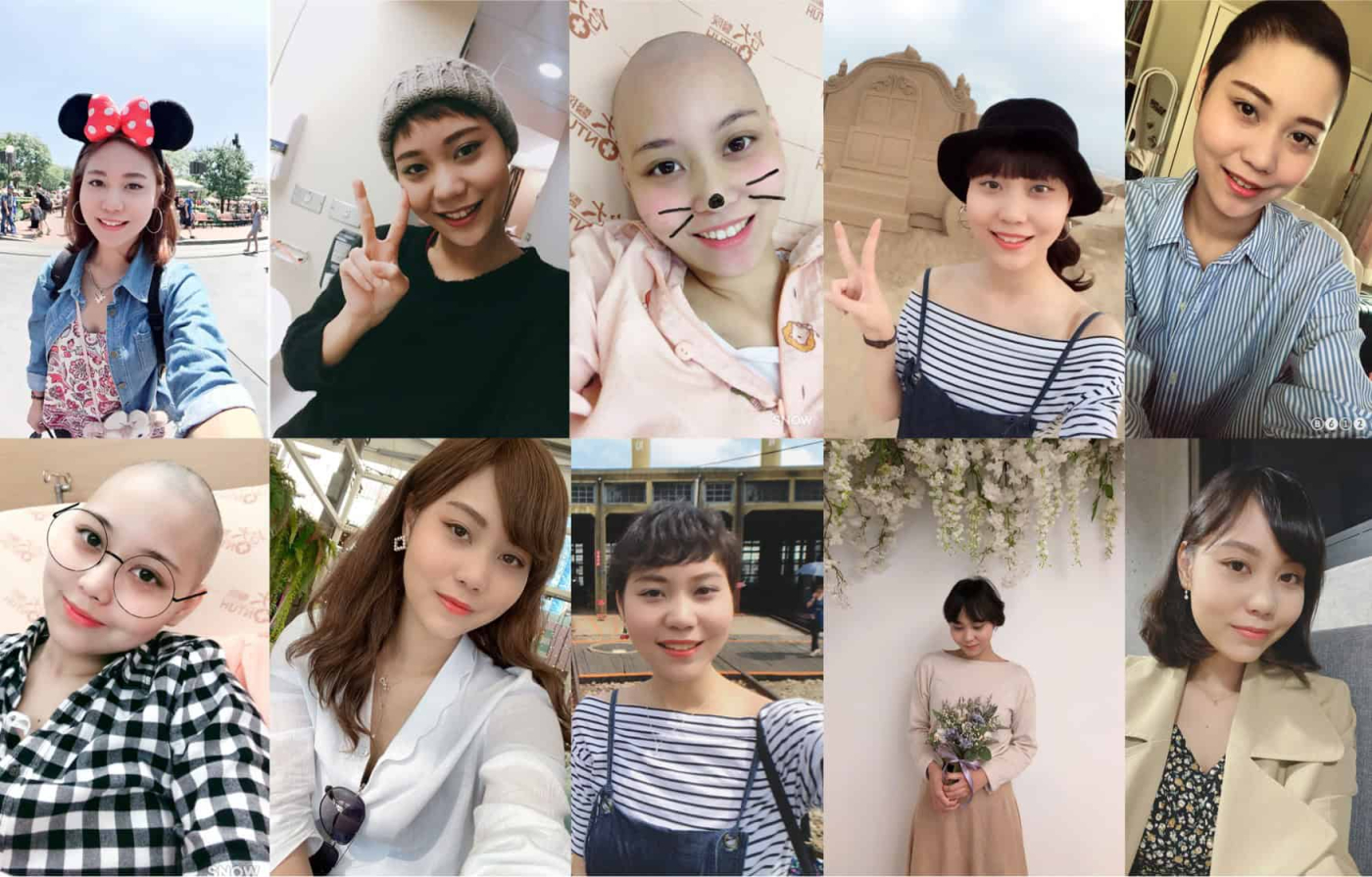 血癌病友抗癌分享｜數次化療、兩次骨髓移植，23歲的她終於重獲新生！