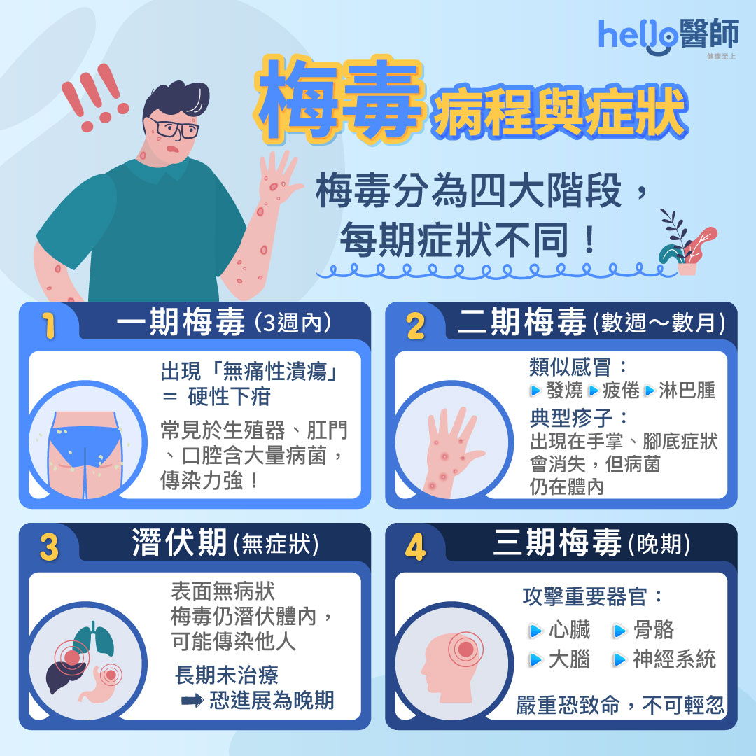 梅毒症狀與進程