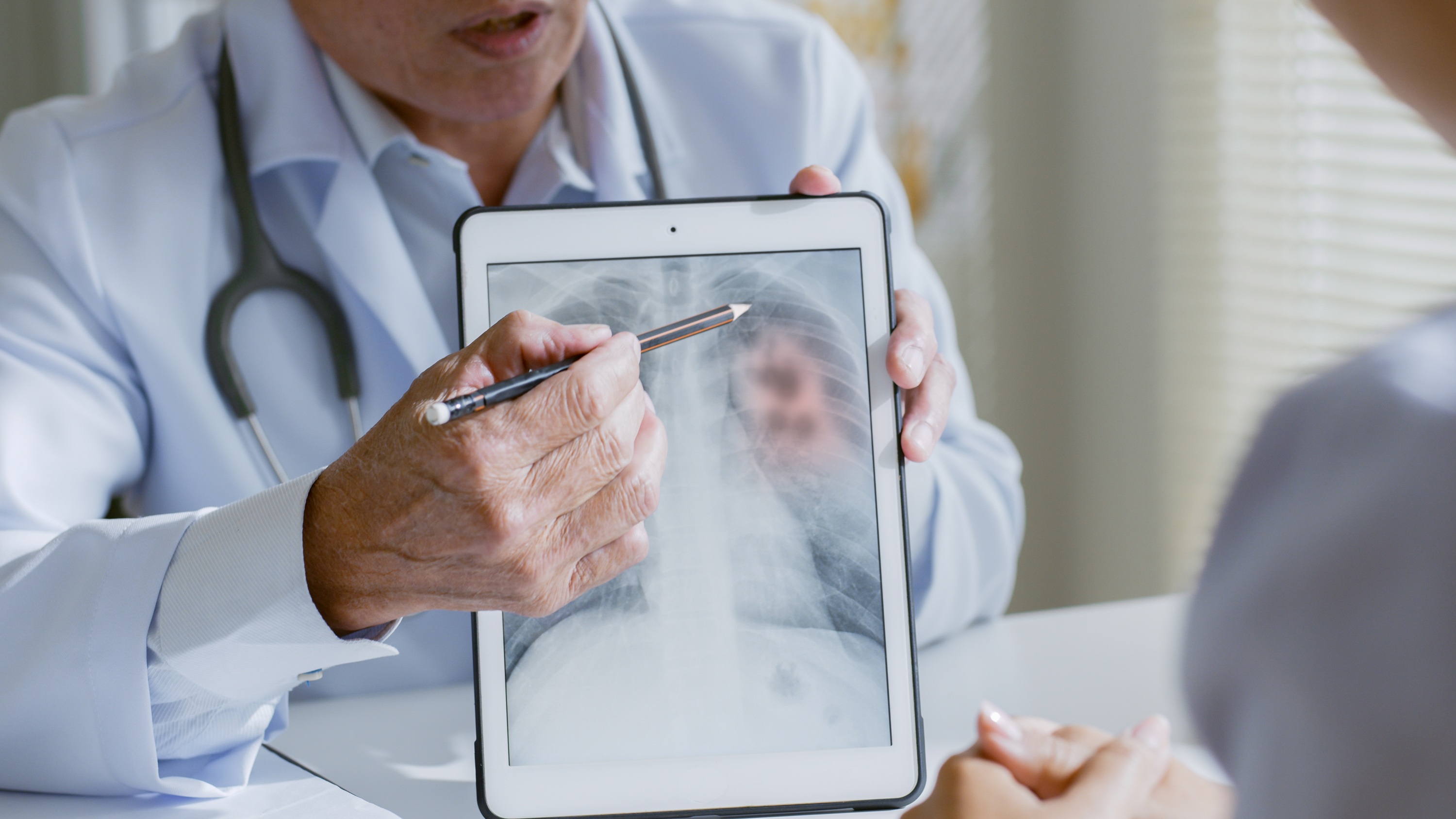 alk-lung-cancer-treatment