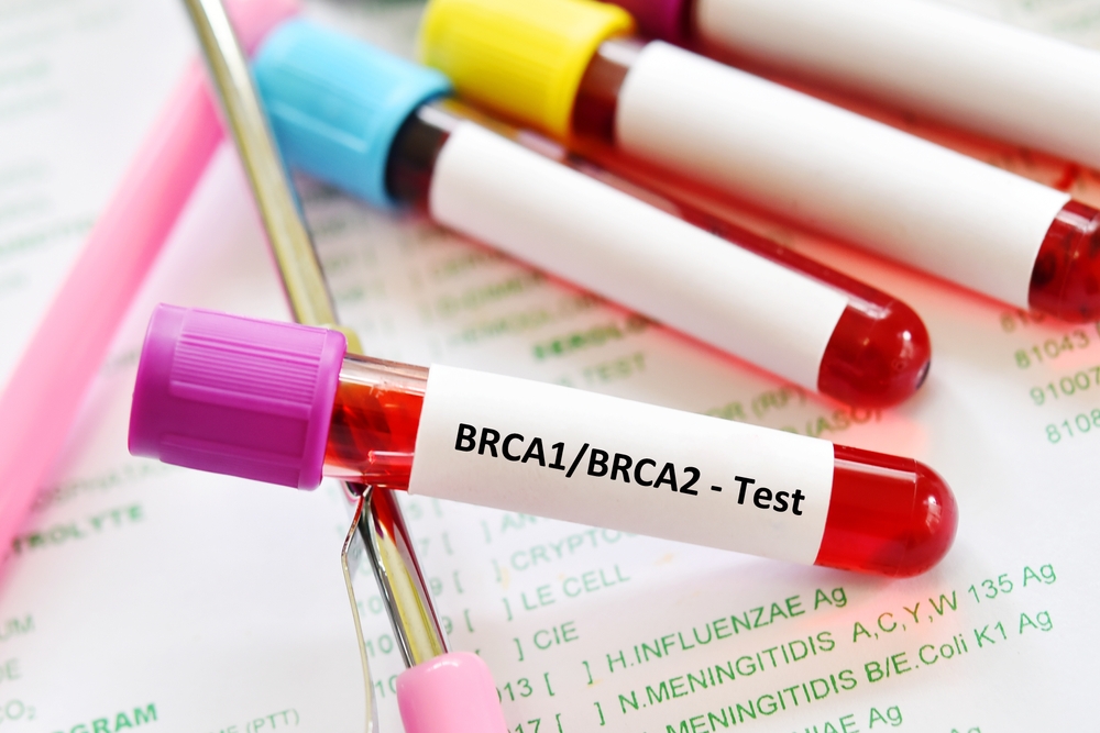 breast-cancer-genetic-testing-guide