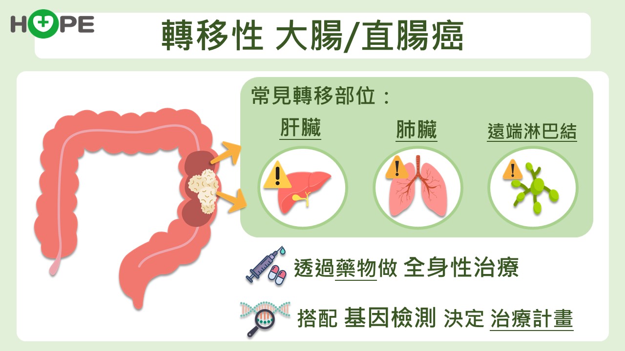 轉移性大腸/直腸癌