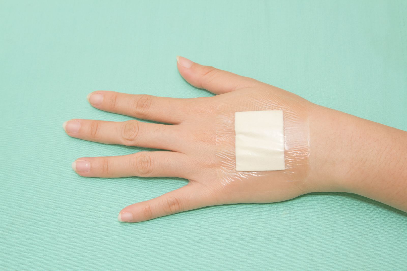 hydrocolloid-dressing-how-to-use